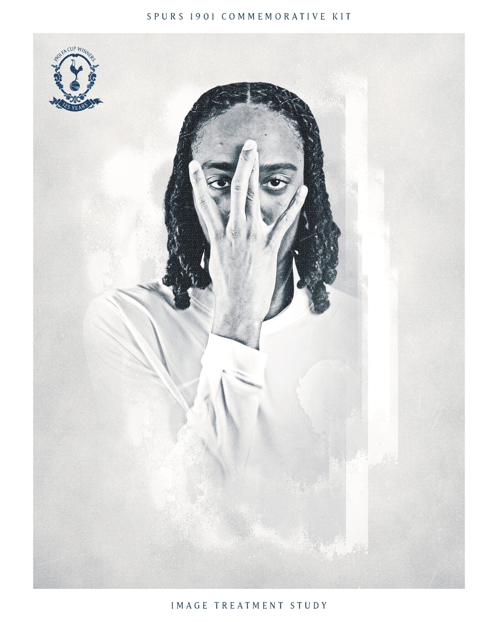 Spurs 1901 treatment study